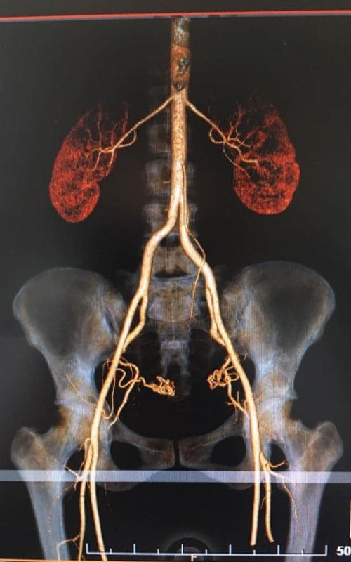 dr-eduardo-cantarell-castillo-cirujano-oncologo-en-veracruz-perfil