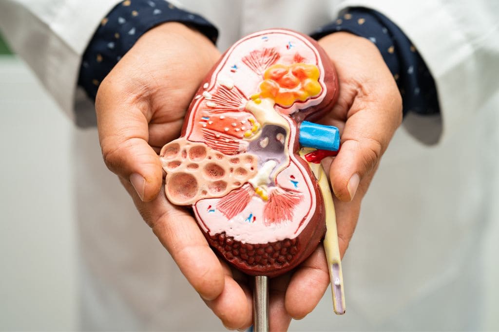 Enfermedad Renal Poliquística
