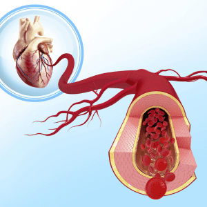 consultas-de-seguimiento