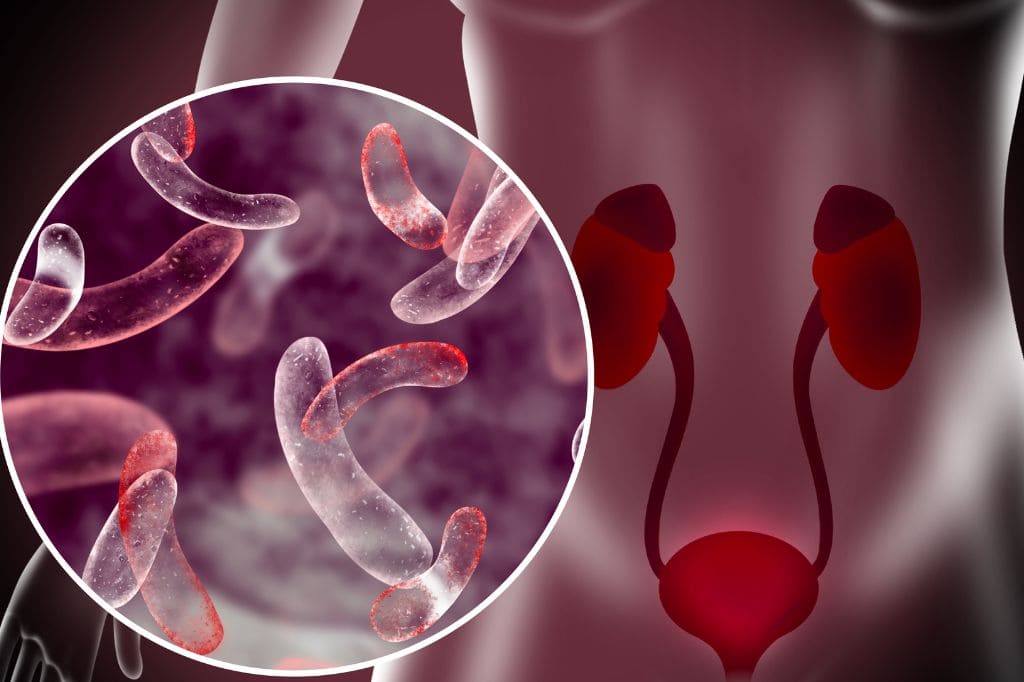 Infecciones de Vías Urinarias